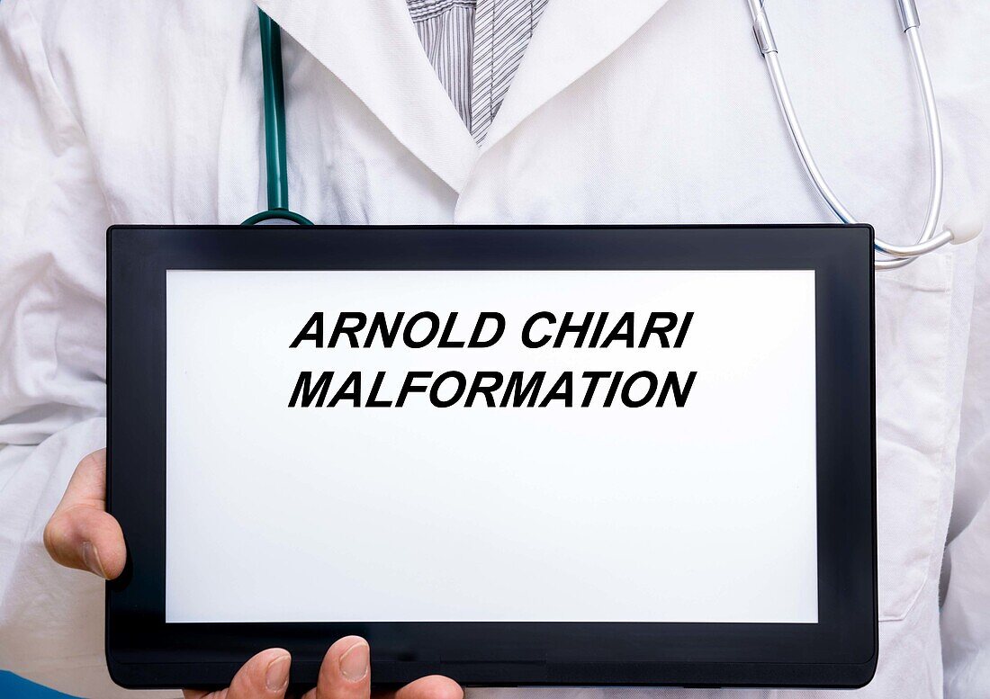 Arnold Chiari malformation, conceptual image