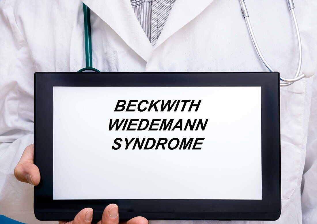 Beckwith-Wiedemann syndrome, conceptual image