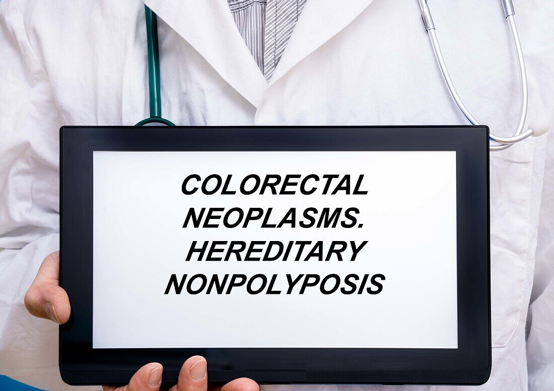 Colorectal neoplasms, conceptual image