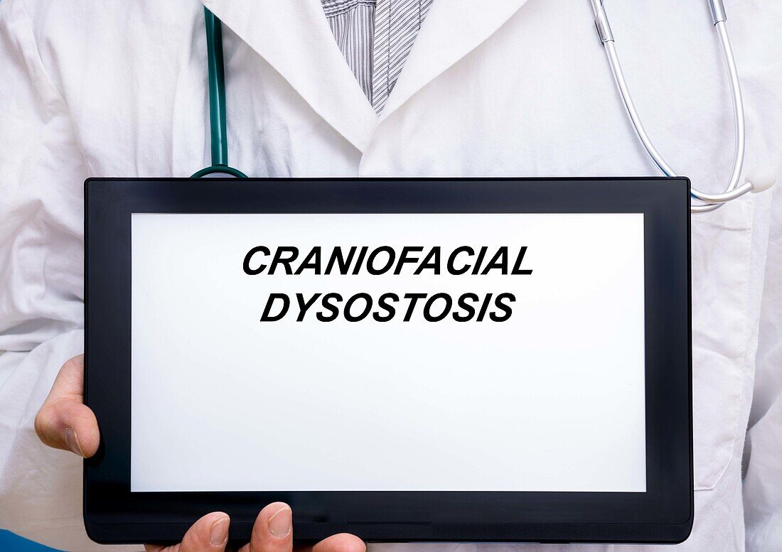 Craniofacial dysostosis, conceptual image