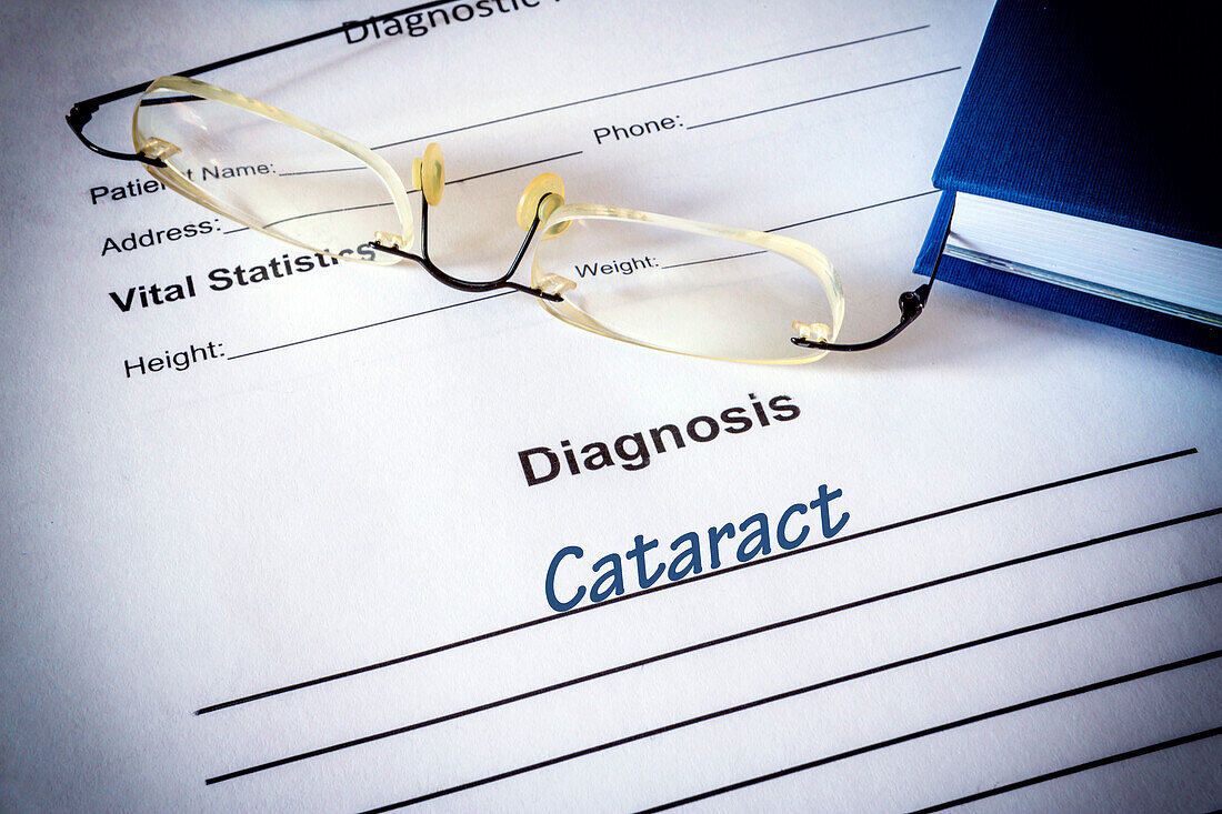 Cataract diagnosis on a medical form, conceptual image