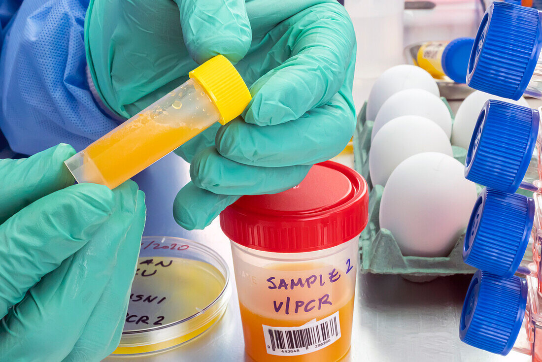 Testing eggs for bird flu, conceptual image
