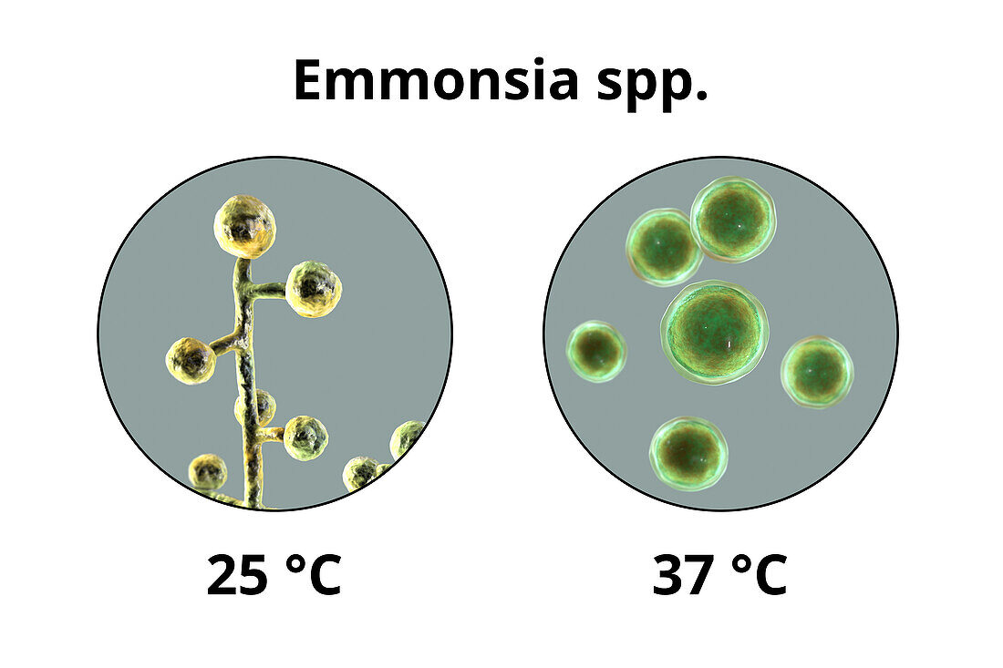 Emmonsia fungi, illustration