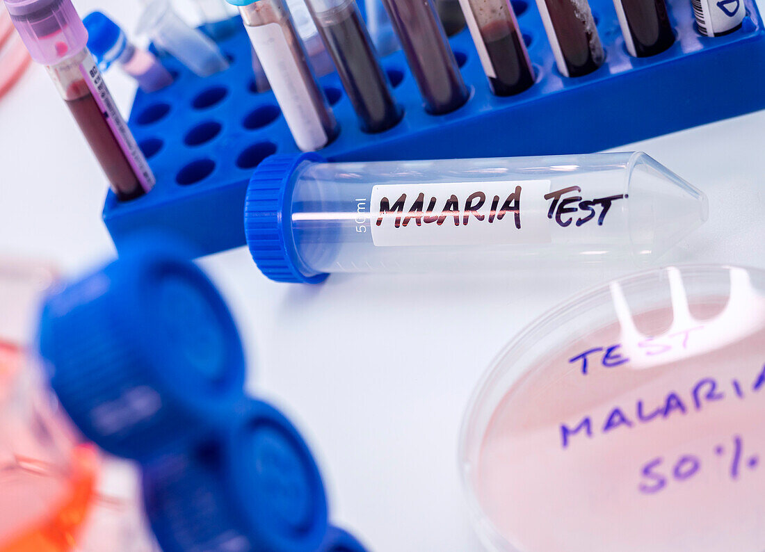 Testing for malaria, conceptual image