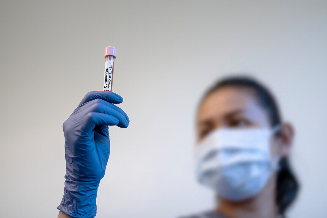 Wissenschaftlerin hält medizinische Probe in Reagenzglas