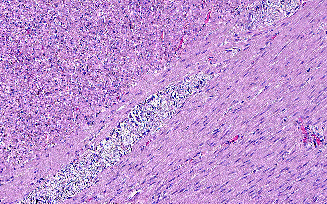 Bowel nerve plexus, light micrograph