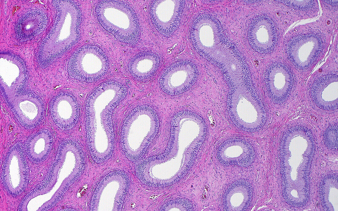 Testis epididymis, light micrograph