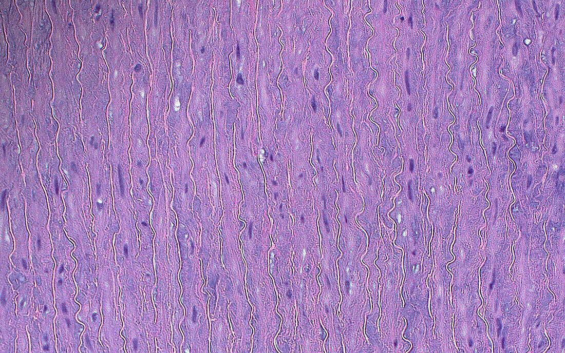 Aorta elastic fibres, light micrograph