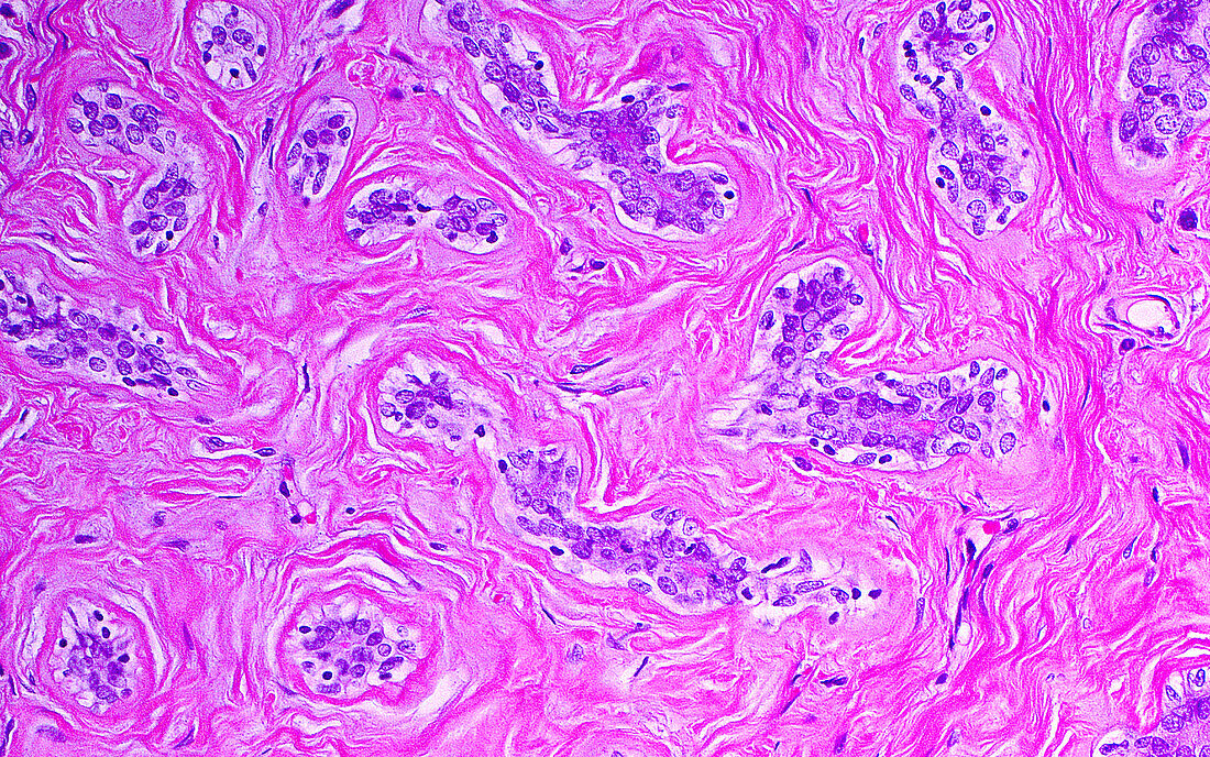 Benign breast tissue, light micrograph