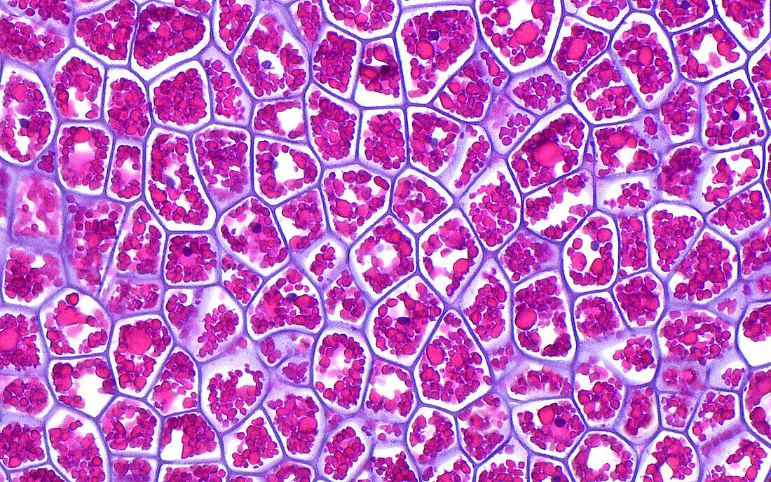Ingested plant cells, light micrograph