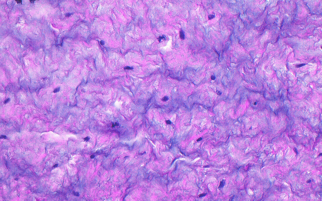 Umbilical cord, light micrograph