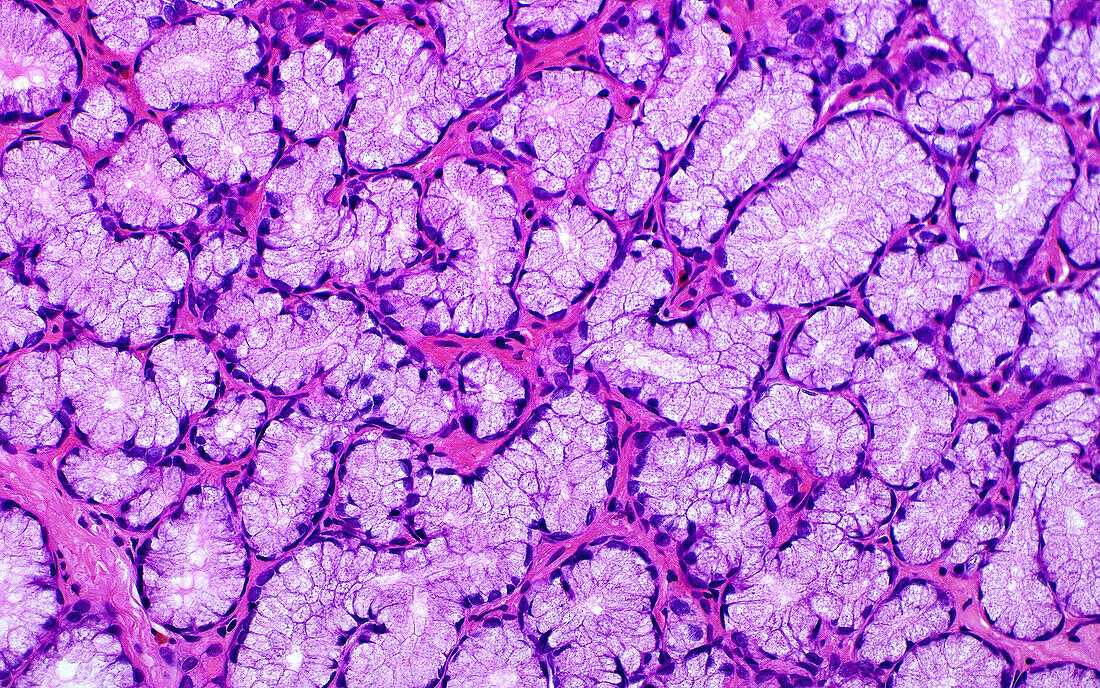Brunnerâ€™s glands in a duodenum, light micrograph