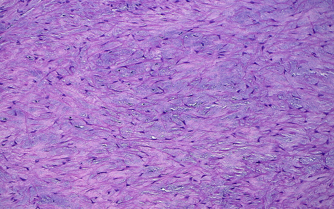 Artery wall intimal layer, light micrograph