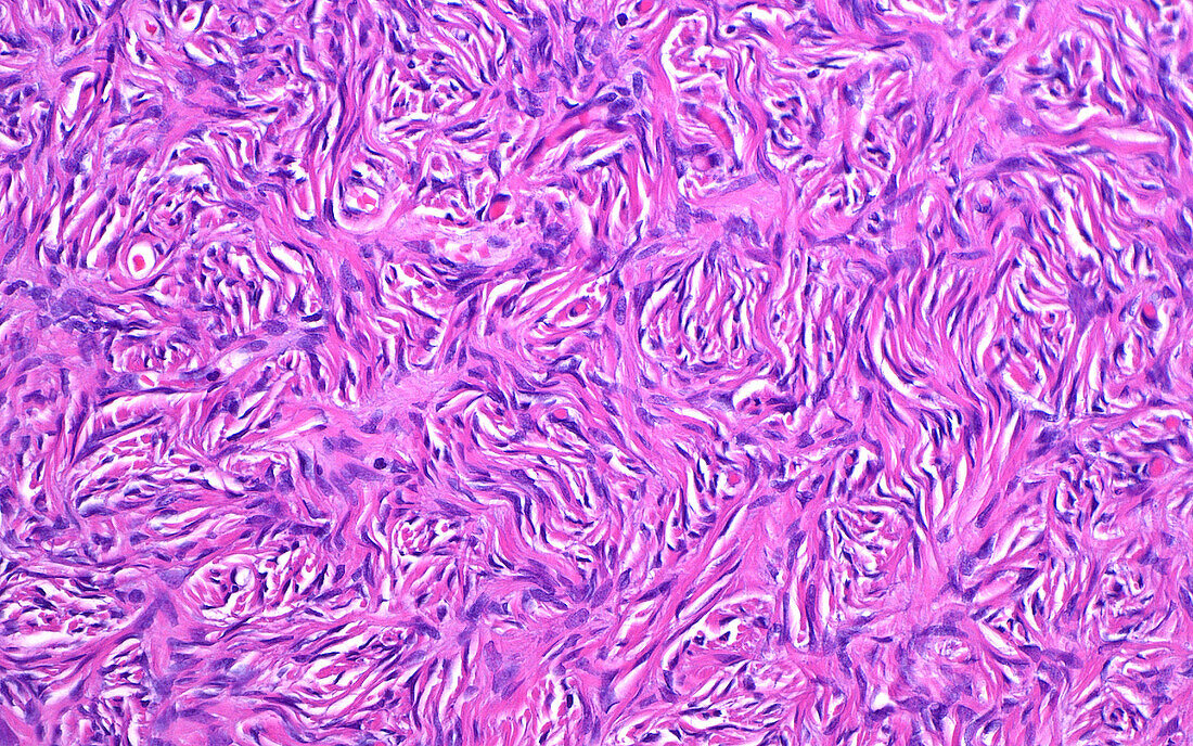 Ovary stromal cells, light micrograph