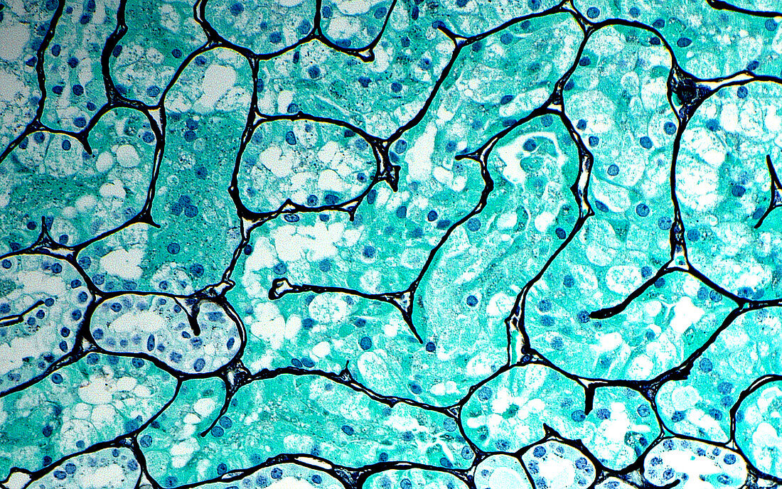 Kidney proximal convoluted tubules, light micrograph
