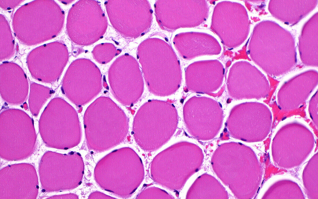 Skeletal muscle cells, light micrograph