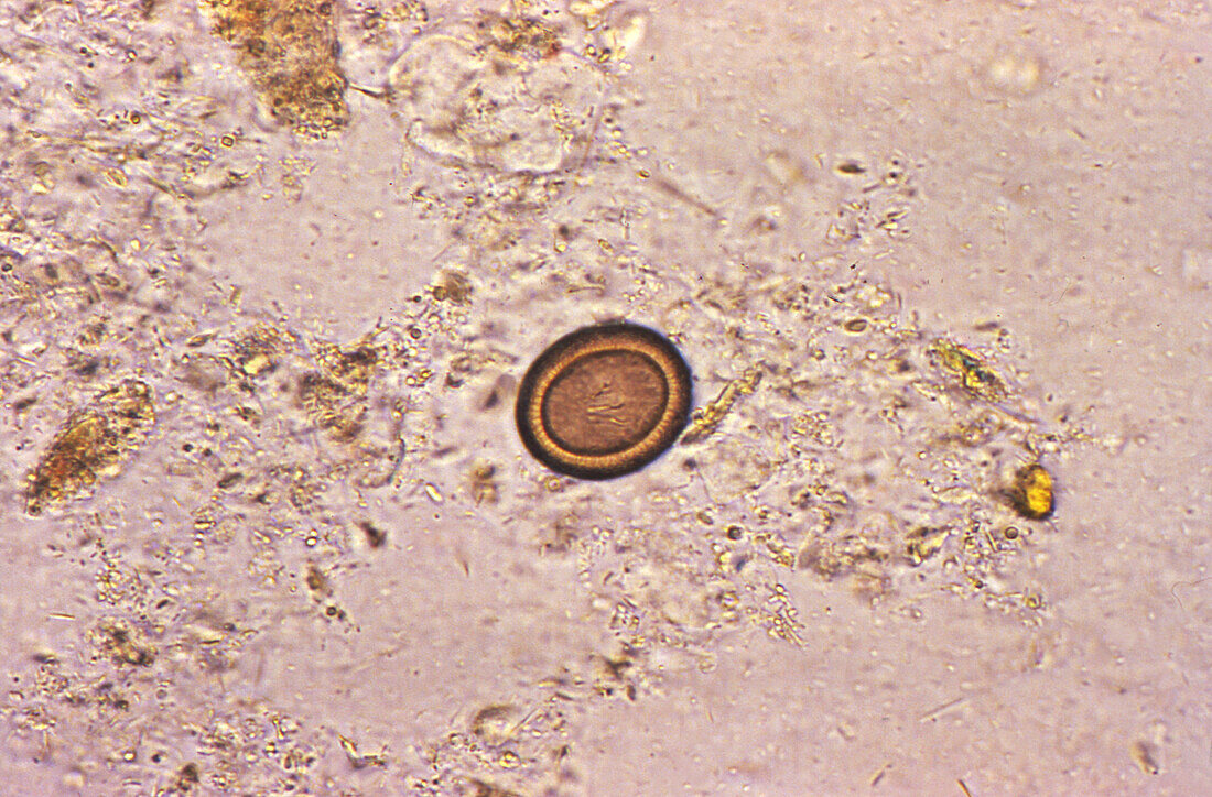 Ovum of a tapeworm, light micrograph