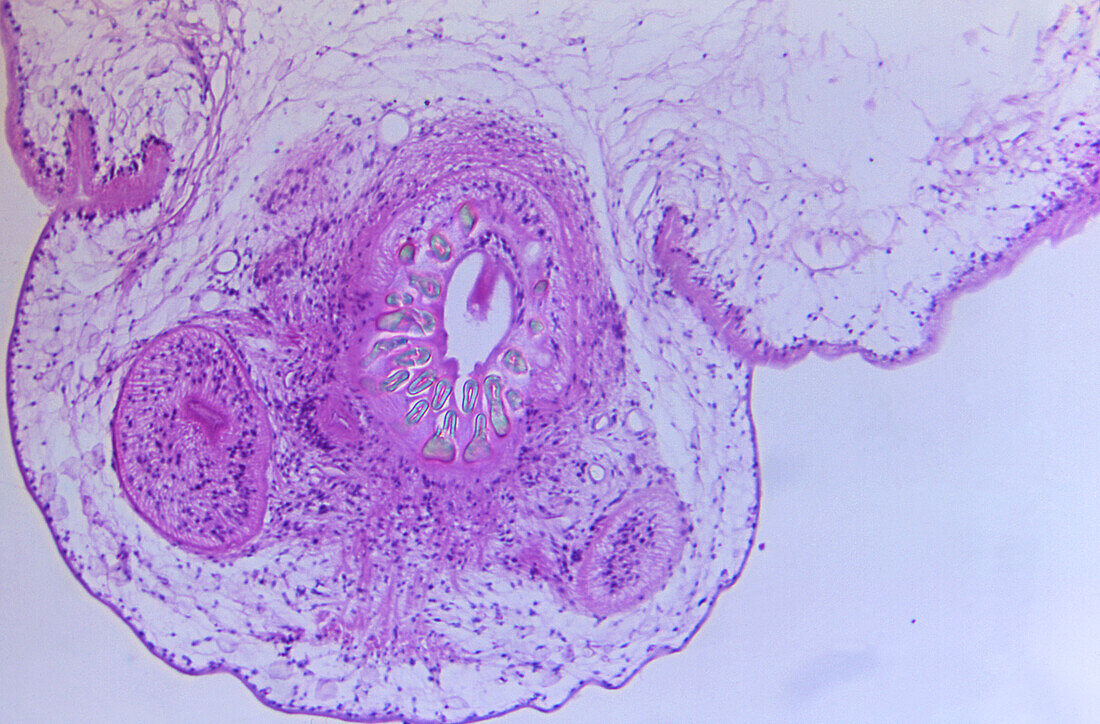 Larval scolex inside a tapeworm coenurus, light micrograph