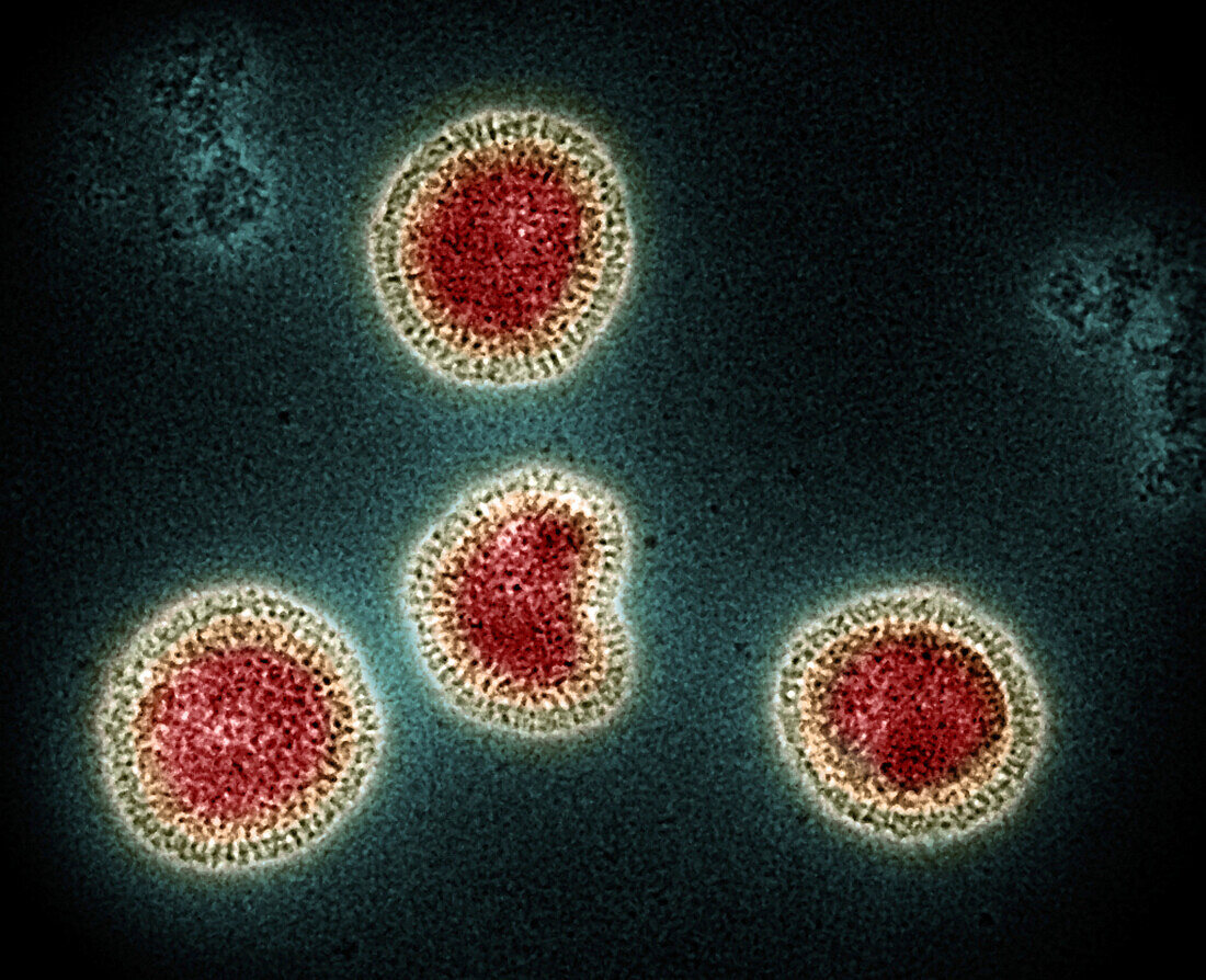 Influenza B virus particles, TEM