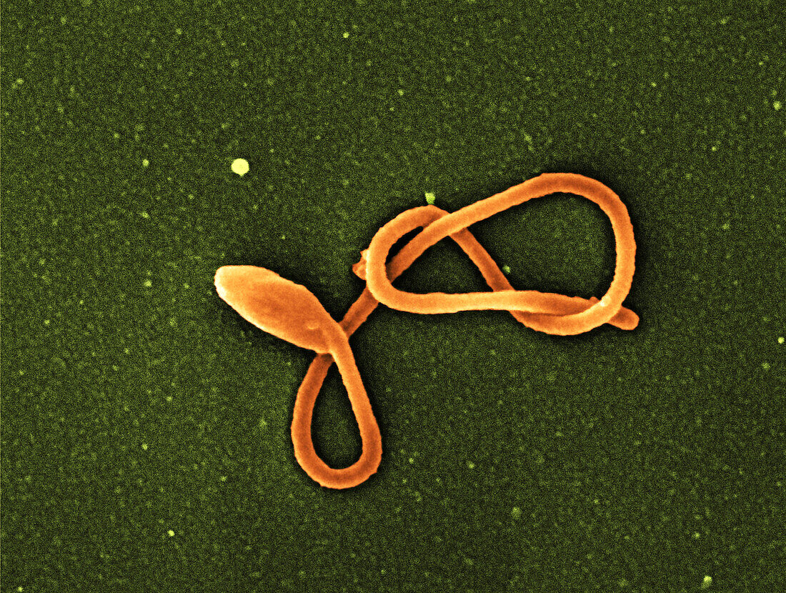Ebola virus particle, SEM