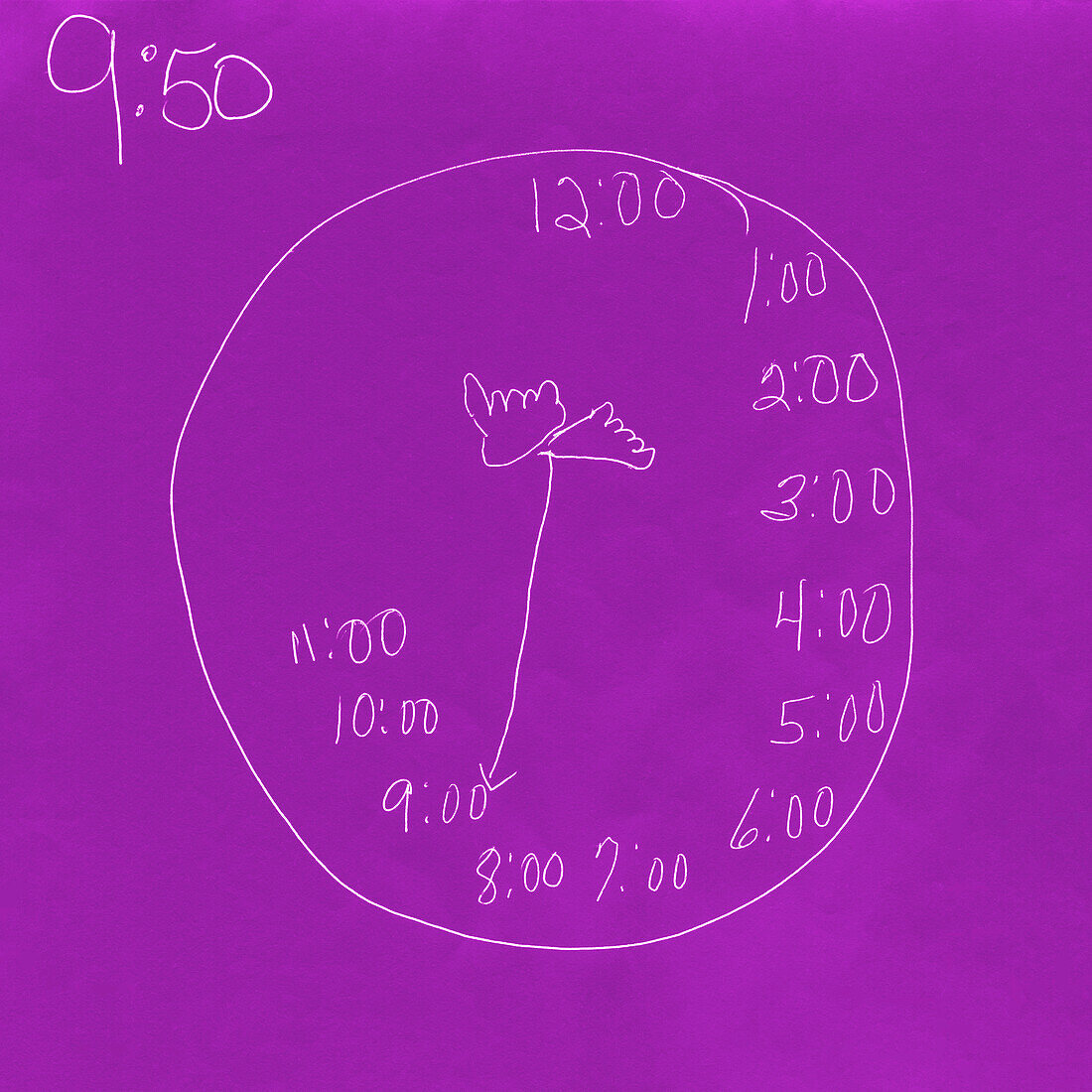 Clock drawn by a patient with Alzheimer's disease