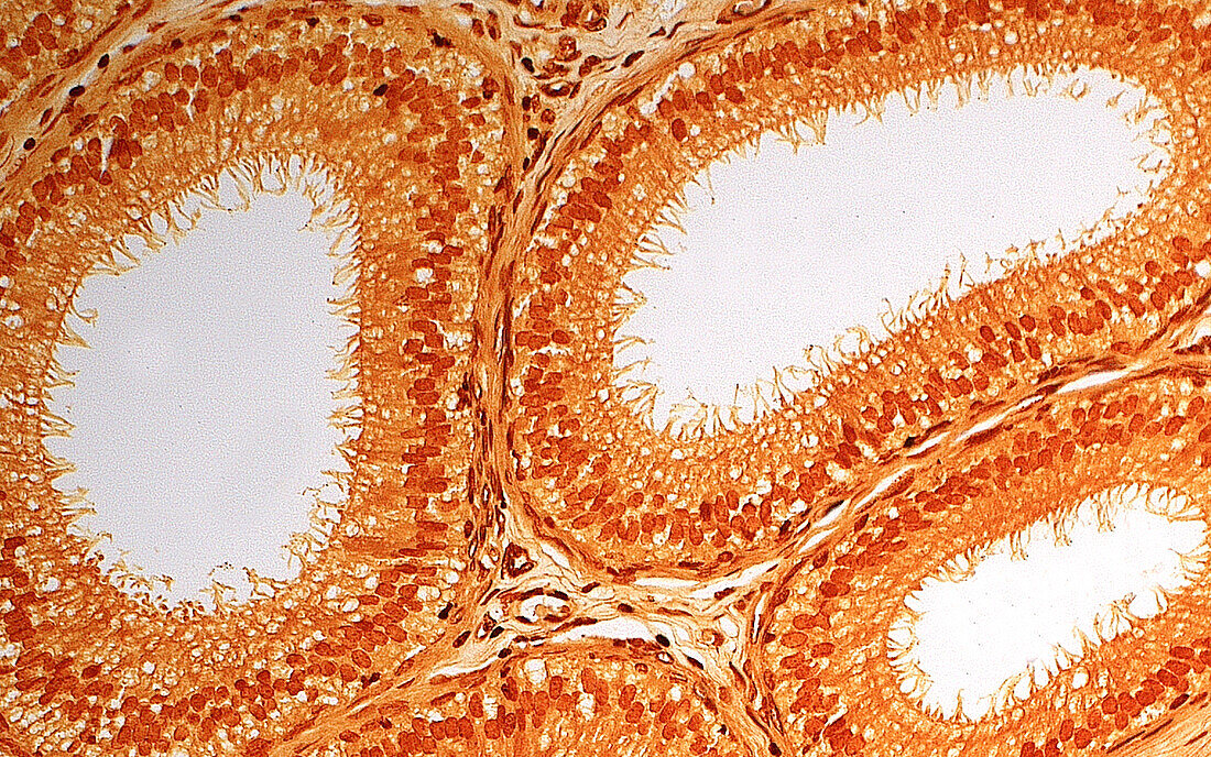 Epididymis, light micrograph