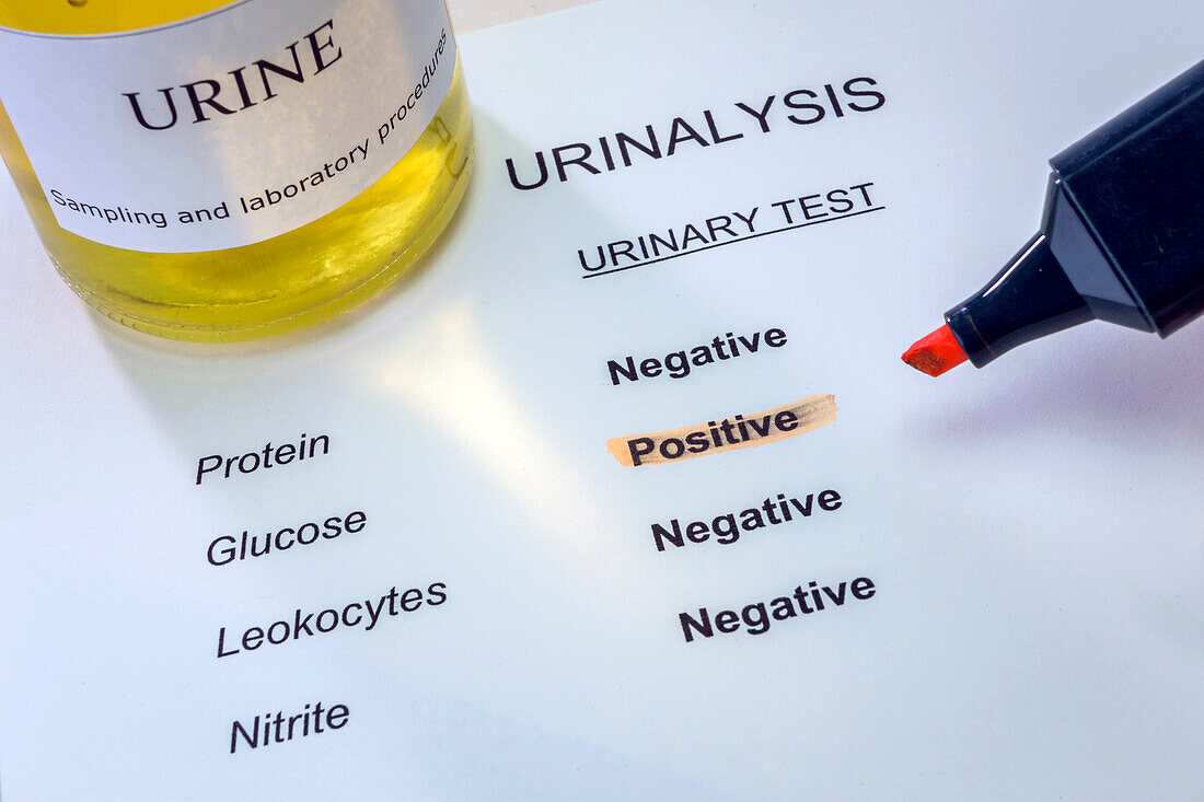 Urine test, conceptual image