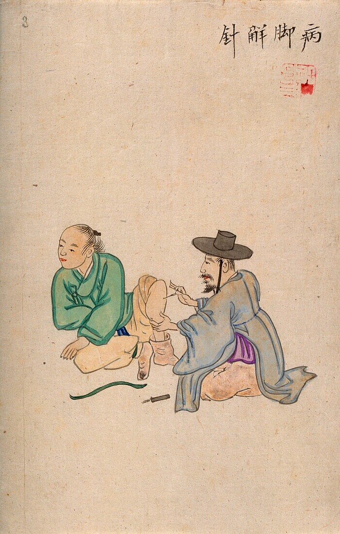 Korean acupuncture, 19th century illustration