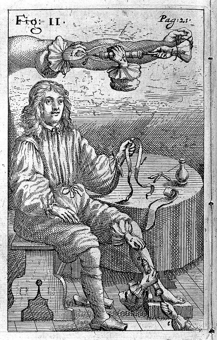 First intravenous injection, 17th century illustration