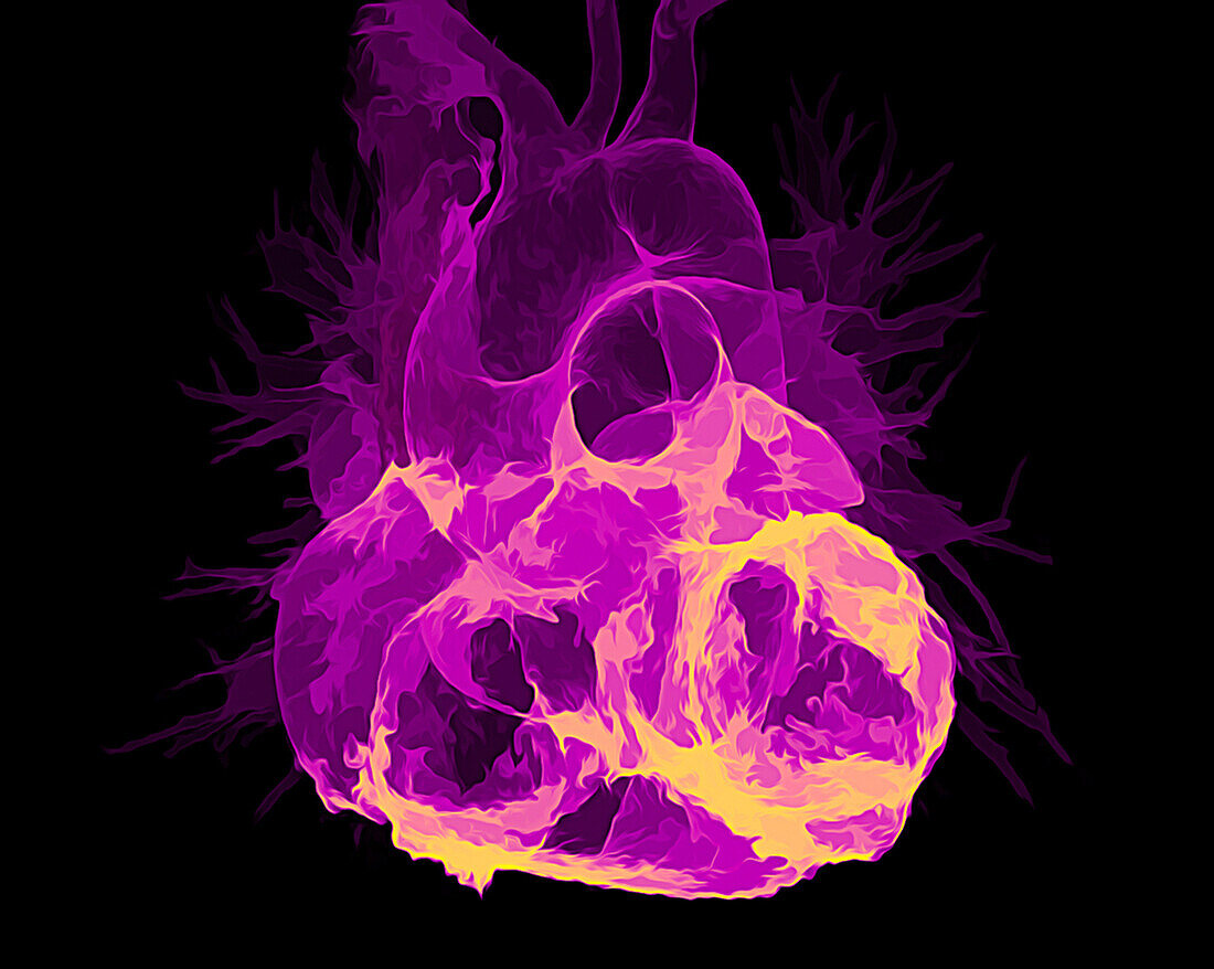 Healthy heart, CT scan