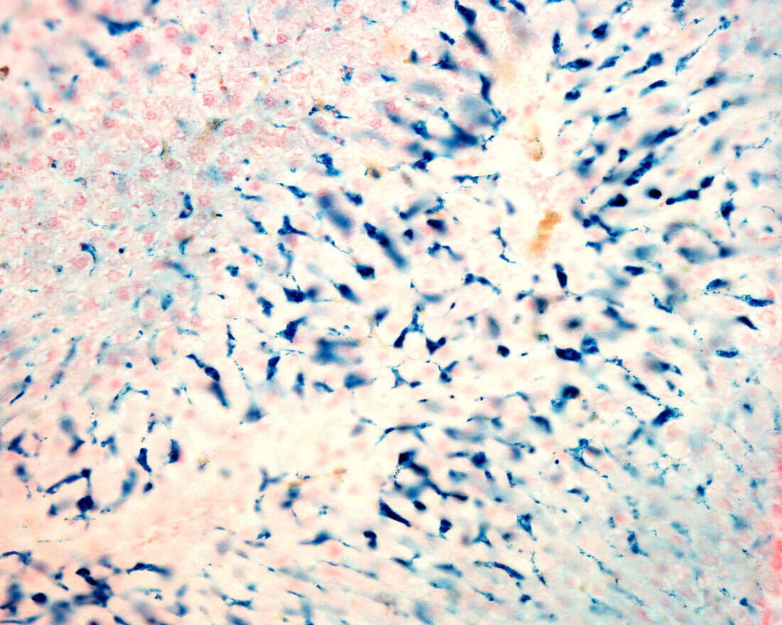 Kupffer cells, light micrograph