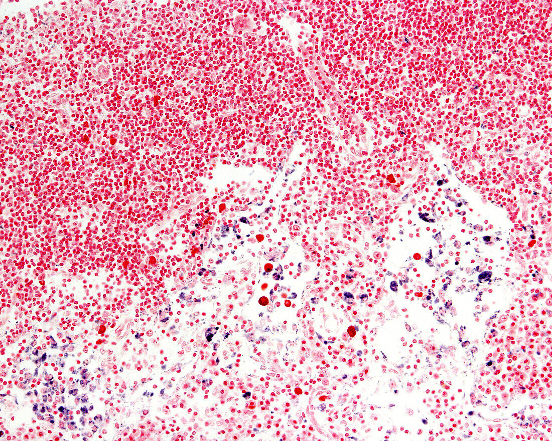 Lymph node macrophages, light micrograph