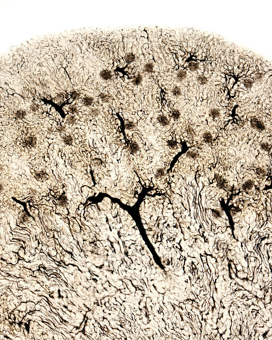 Kidney blood vessels, light micrograph