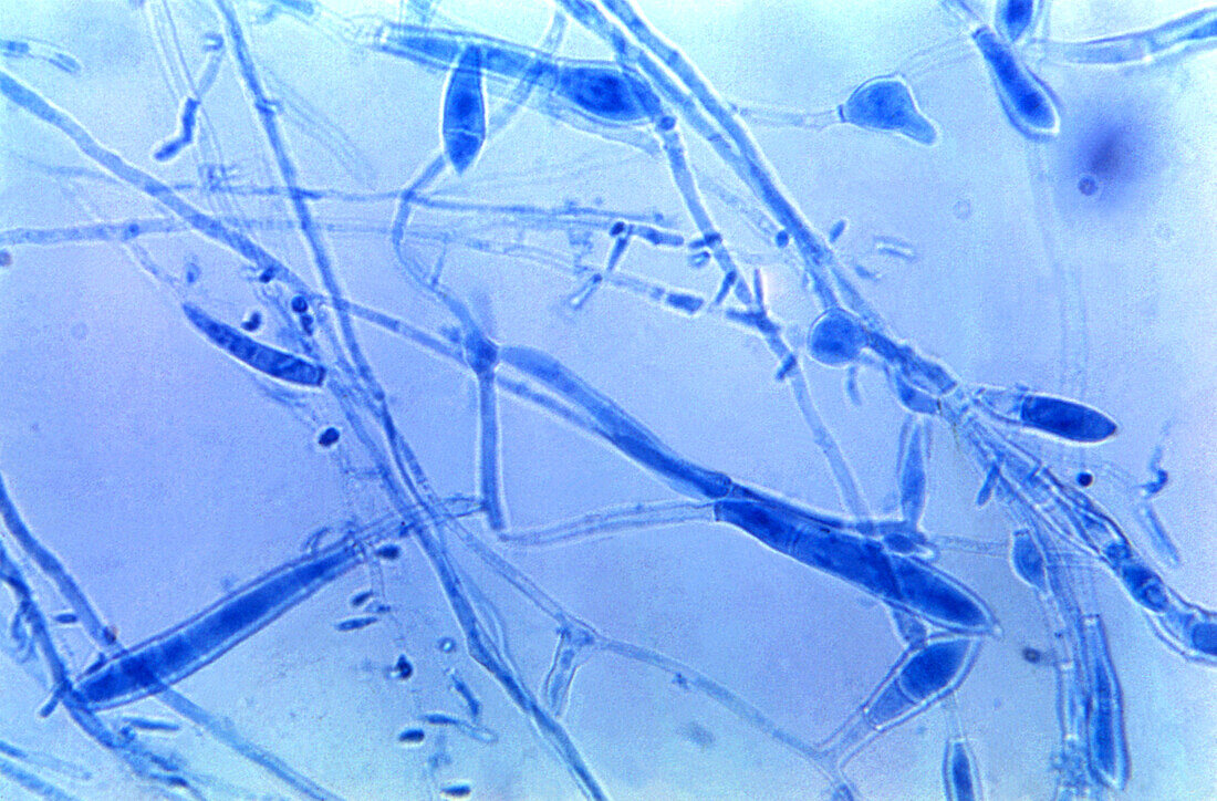 Ringworm fungus, light micrograph