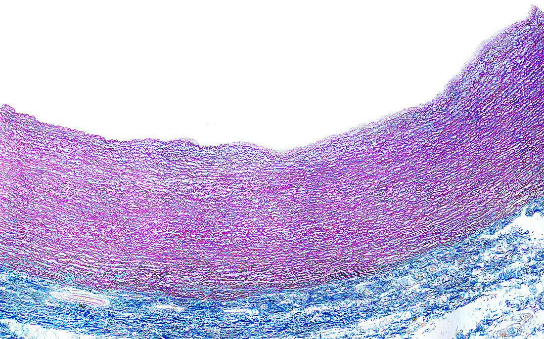 Aorta wall, light micrograph