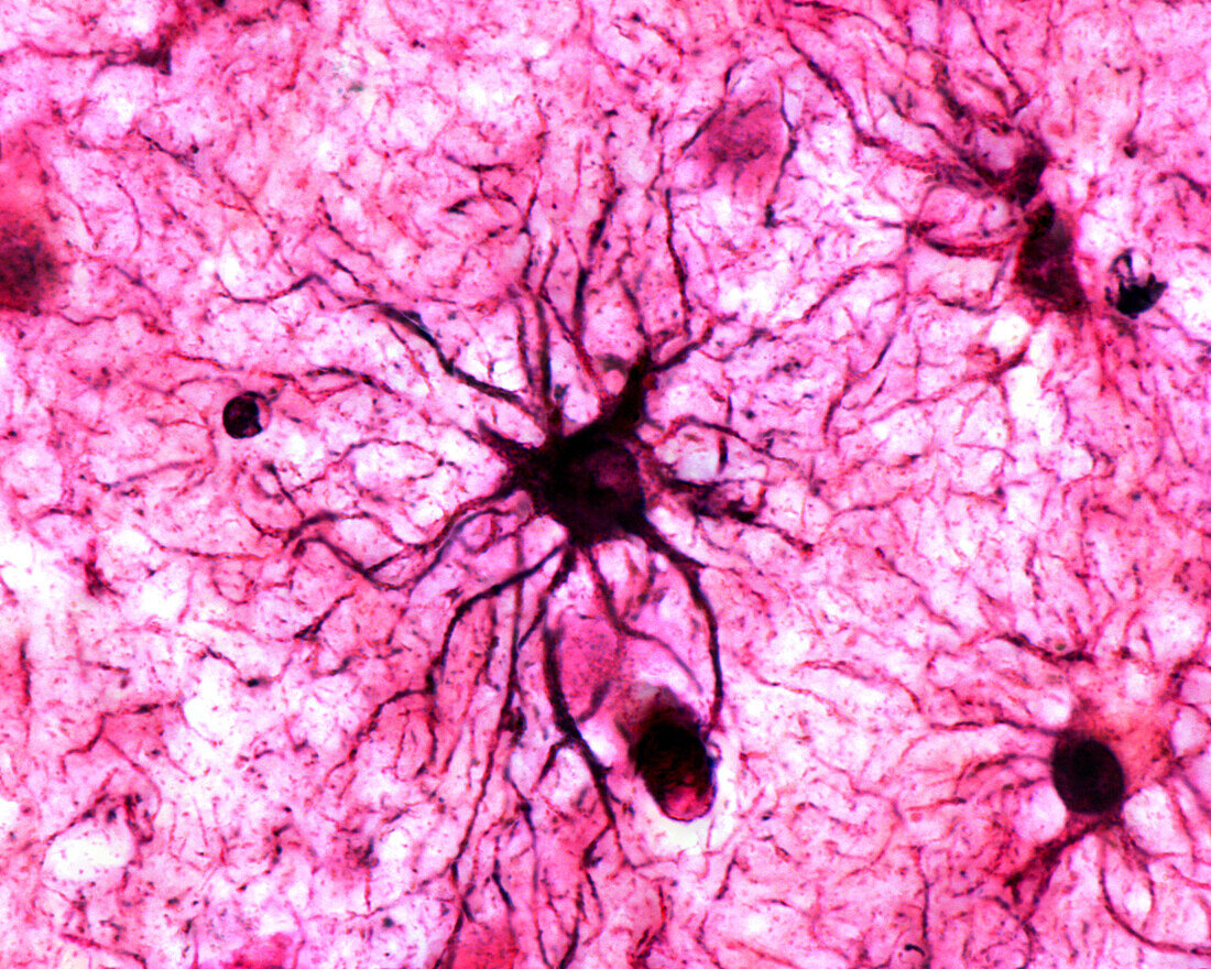Astrocyte, light micrograph
