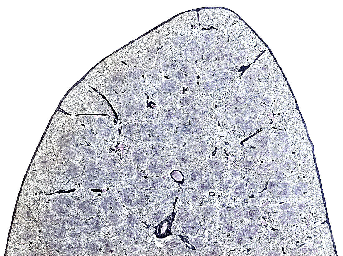Human spleen, light micrograph