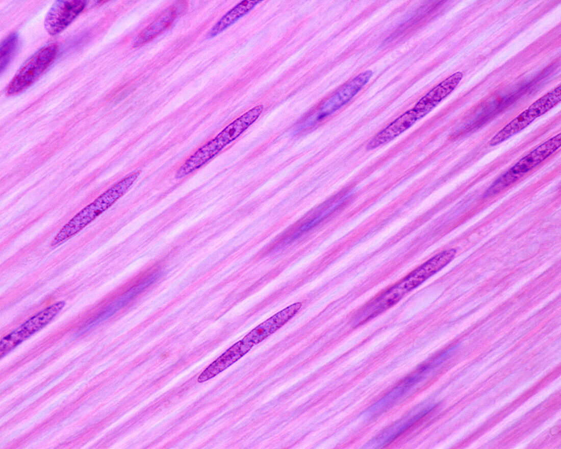 Smooth muscle fibres, light micrograph