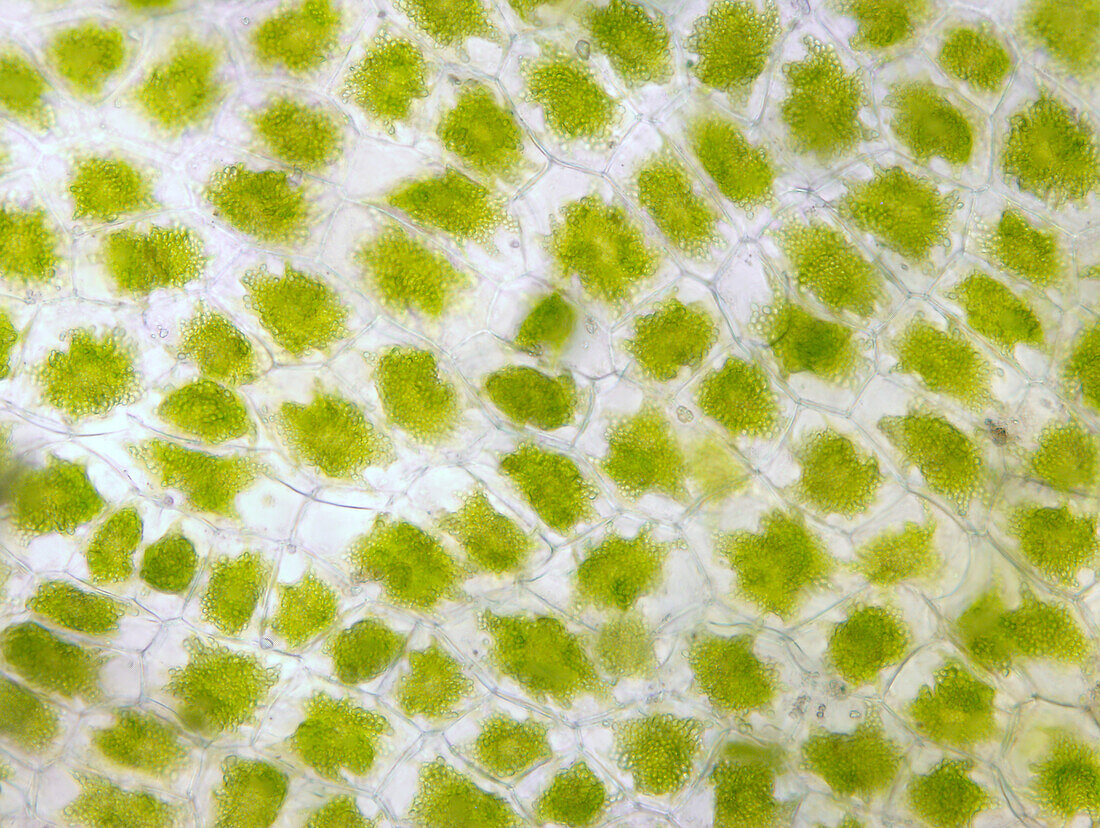 Hornwort thallus cells with plastids, light micrograph