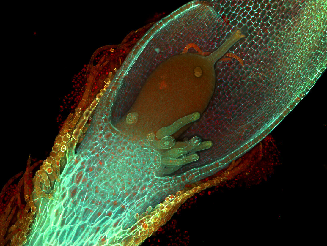Liverwort gametophore with archegonia, fluorescence micrograph