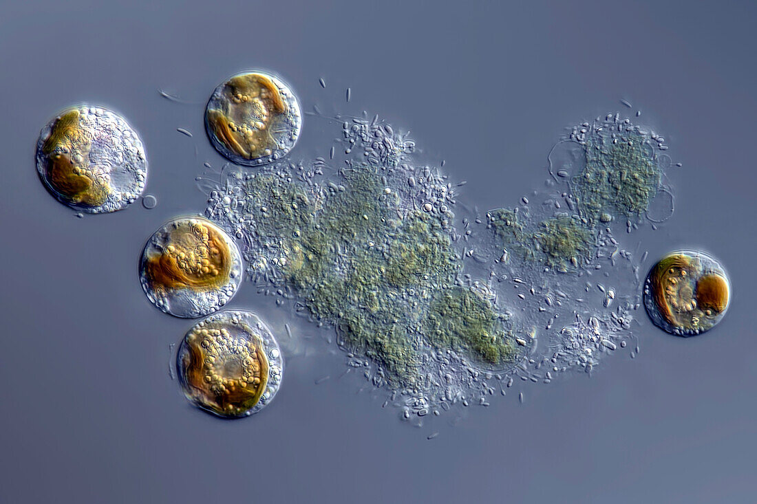 Coccolithophoride algae, light micrograph