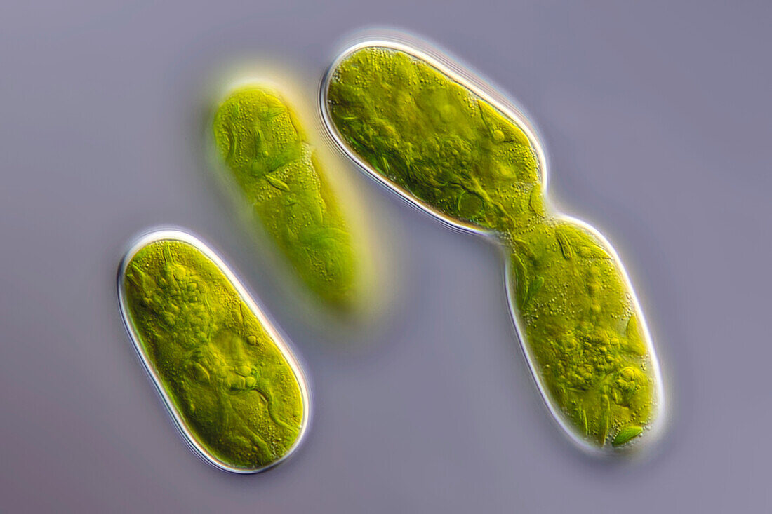 Cylindrocystis sp. algae, light micrograph