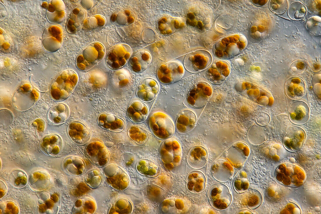 Diatom algae, light micrograph