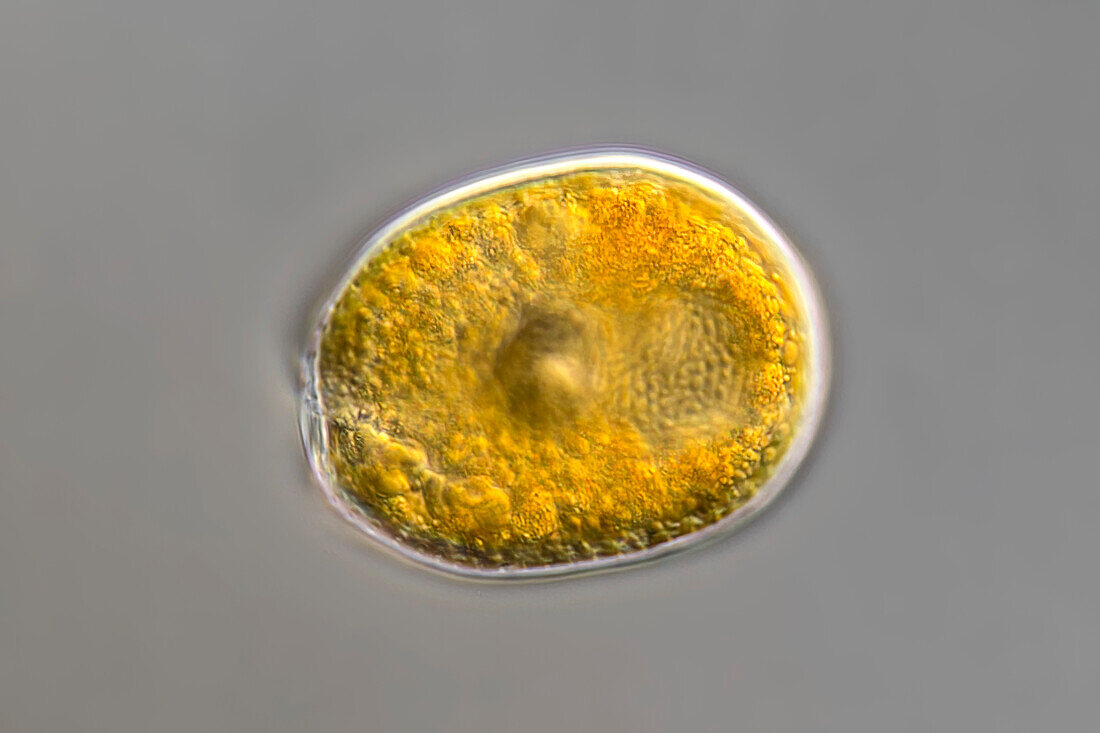 Prorocentrum lima algae, light micrograph