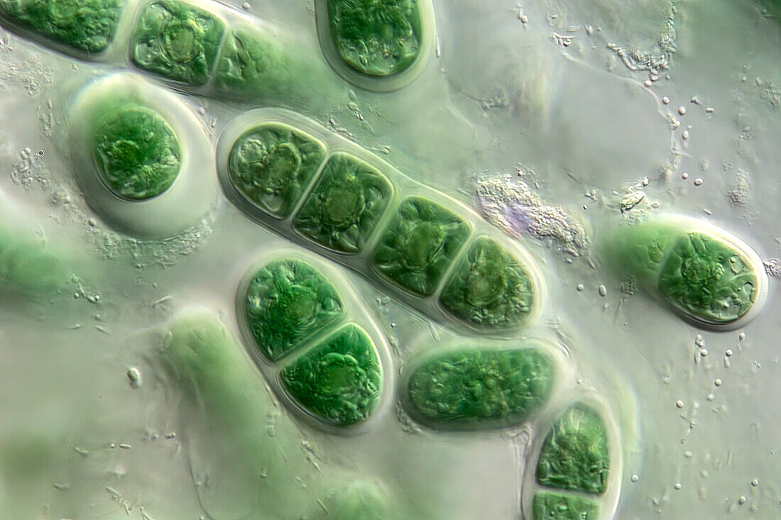 Chroodactylon ornatum algae, light micrograph