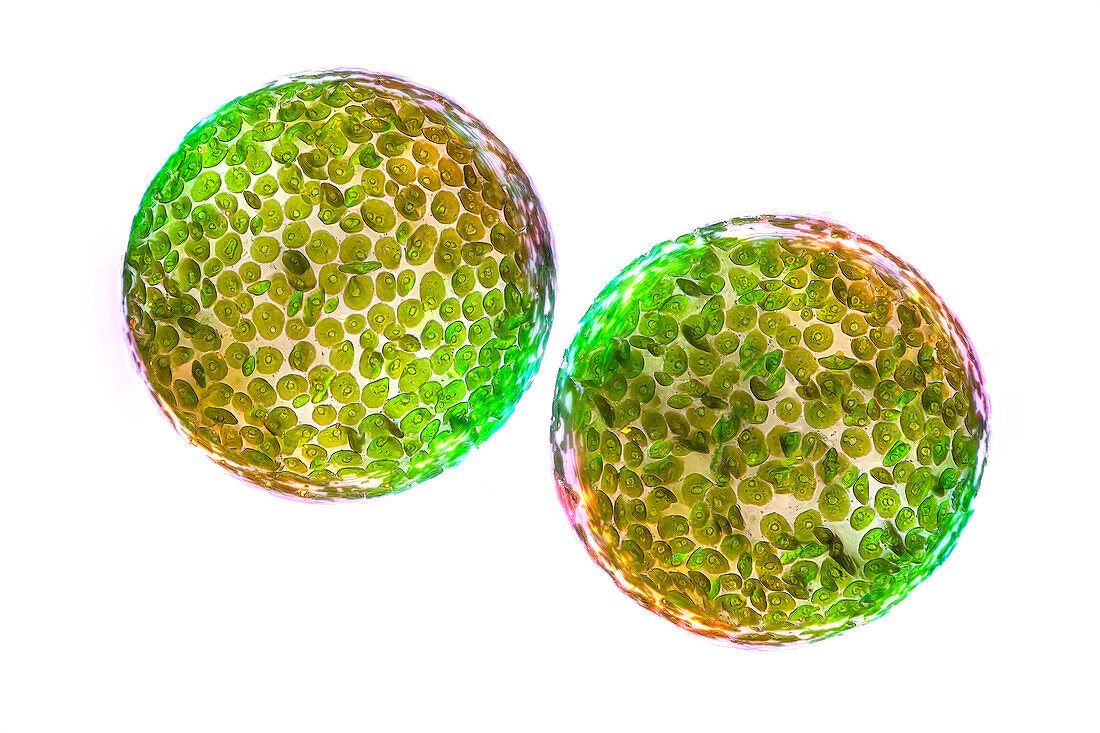 Eremosphaera viridis algae, light micrograph
