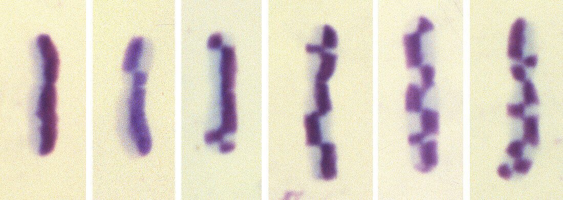 Harlequin chromosomes, light micrograph