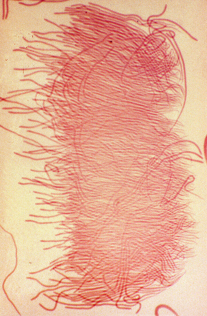 Grasshopper spermatozoa, light micrograph