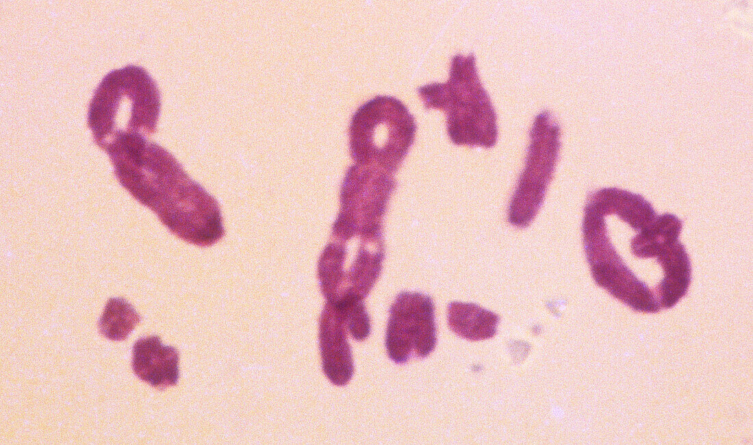 Crossing over during meiosis, light micrograph
