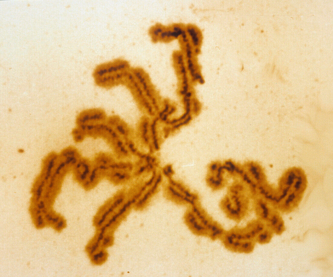 Damaged chromosomes, light micrograph